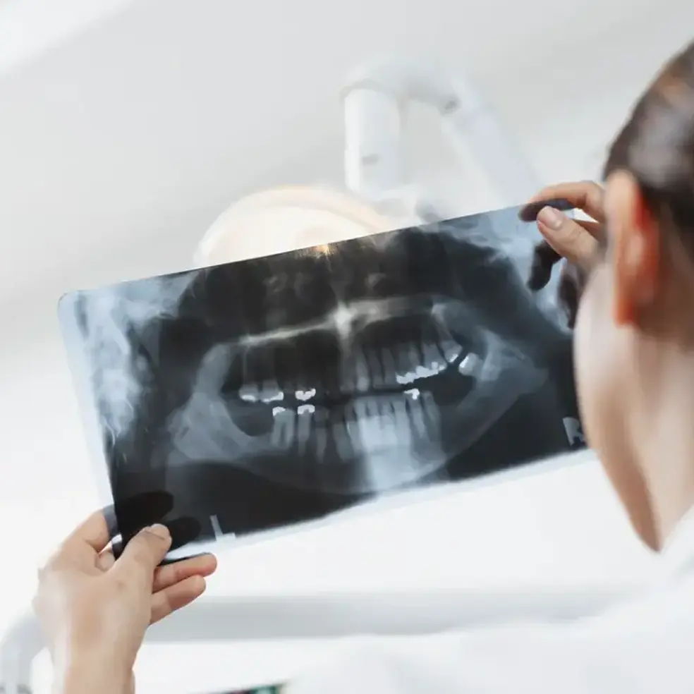 digital dental X-ray